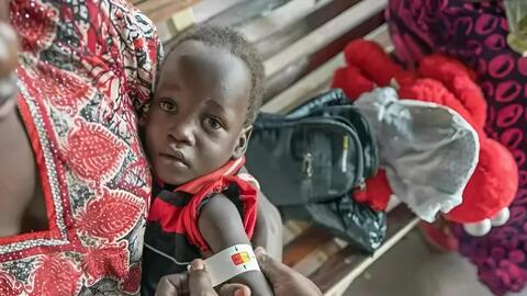 UNICEF: Hơn 450.000 trẻ em ở Nam Sudan có nguy cơ suy dinh dưỡng cấp tính