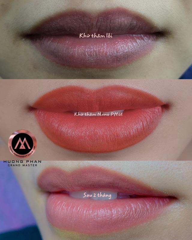 Cùng làm đẹp môi tại thẩm mỹ viện Hương Phan Beauty - Ảnh 7. Cùng làm đẹp môi tại thẩm mỹ viện Hương Phan Beauty - Ảnh 7.