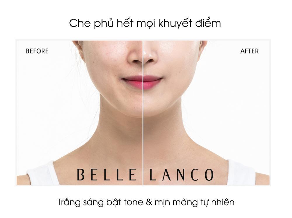 Dùng kem chống nắng mỗi ngày nhưng da vẫn đen sạm và xuống cấp? Đây là câu trả lời! - Ảnh 5. Dùng kem chống nắng mỗi ngày nhưng da vẫn đen sạm và xuống cấp? Đây là câu trả lời! - Ảnh 5.