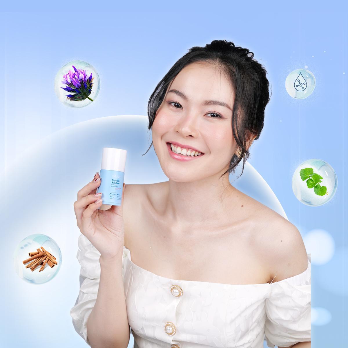 Lấy lại làn da mịn màng với bí quyết ngăn ngừa mụn hiệu quả - Ảnh 3. Lấy lại làn da mịn màng với bí quyết ngăn ngừa mụn hiệu quả - Ảnh 3.