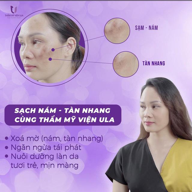 Tại sao hàng nghìn phụ nữ đã chọn thẩm mỹ viện Ula là nơi “lột xác” làn da thâm nám? - Ảnh 1.