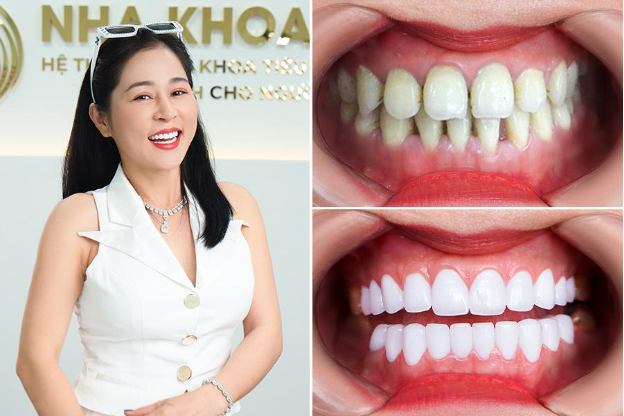 Nha khoa I-Dent - Một thập kỷ chăm sóc nụ cười Việt - Ảnh 3.