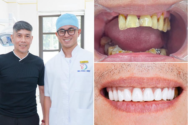 Nha khoa I-Dent - Một thập kỷ chăm sóc nụ cười Việt - Ảnh 2.